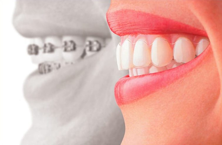 orthodontist specialist in lahore