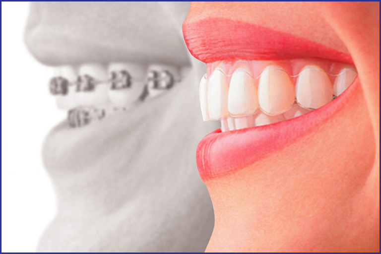 orthodontist specialist in lahore