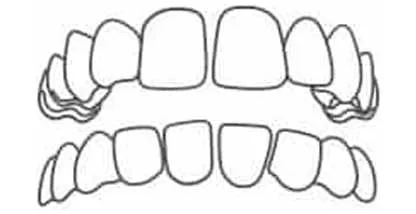 Gap Teeth
