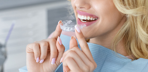 Clear Aligners Dentist