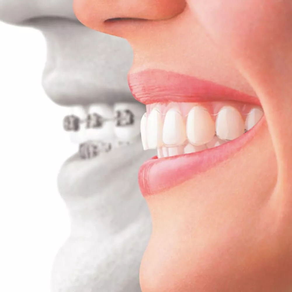 orthodontist specialist in lahore
