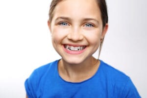 Cost of Dental braces in pakistan