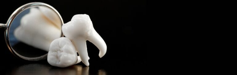 tooth implants