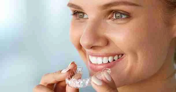 Clear Aligners