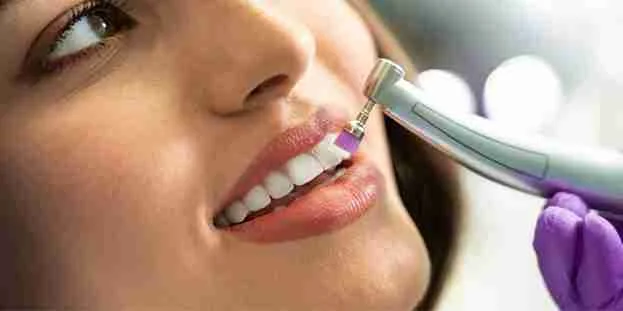 teeth scaling and polishing