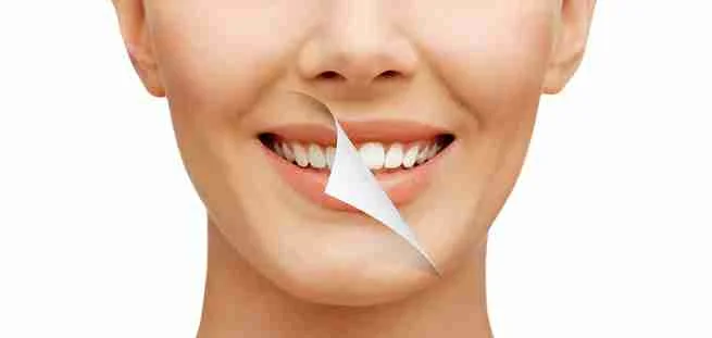 Teeth Whitening Lahore