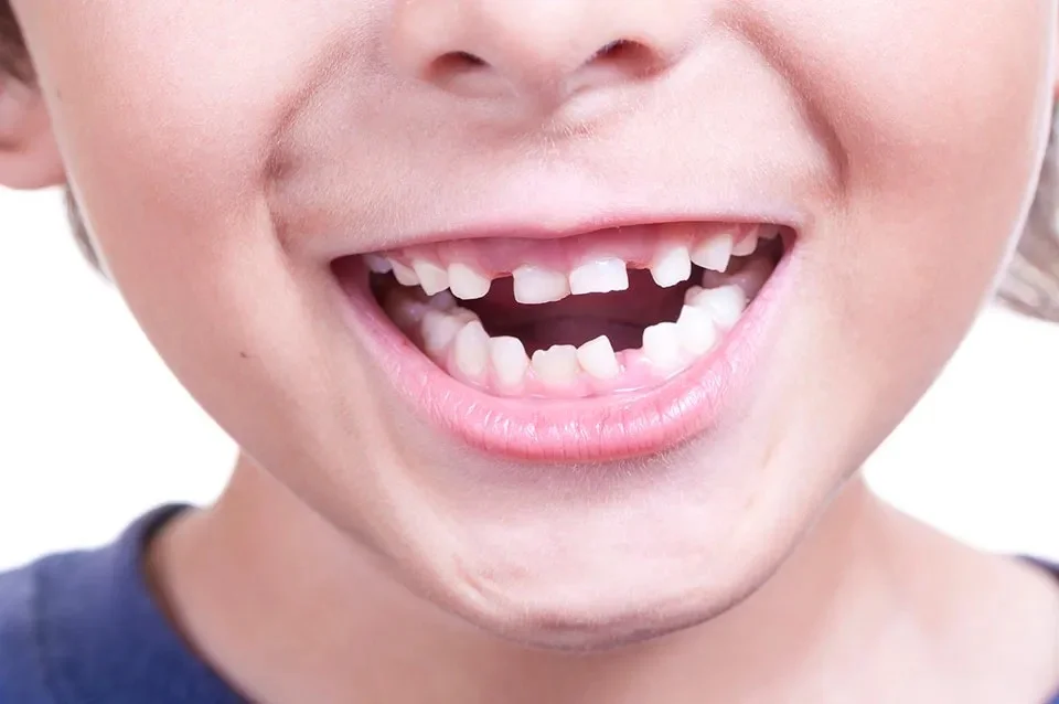 chipped tooth enamel