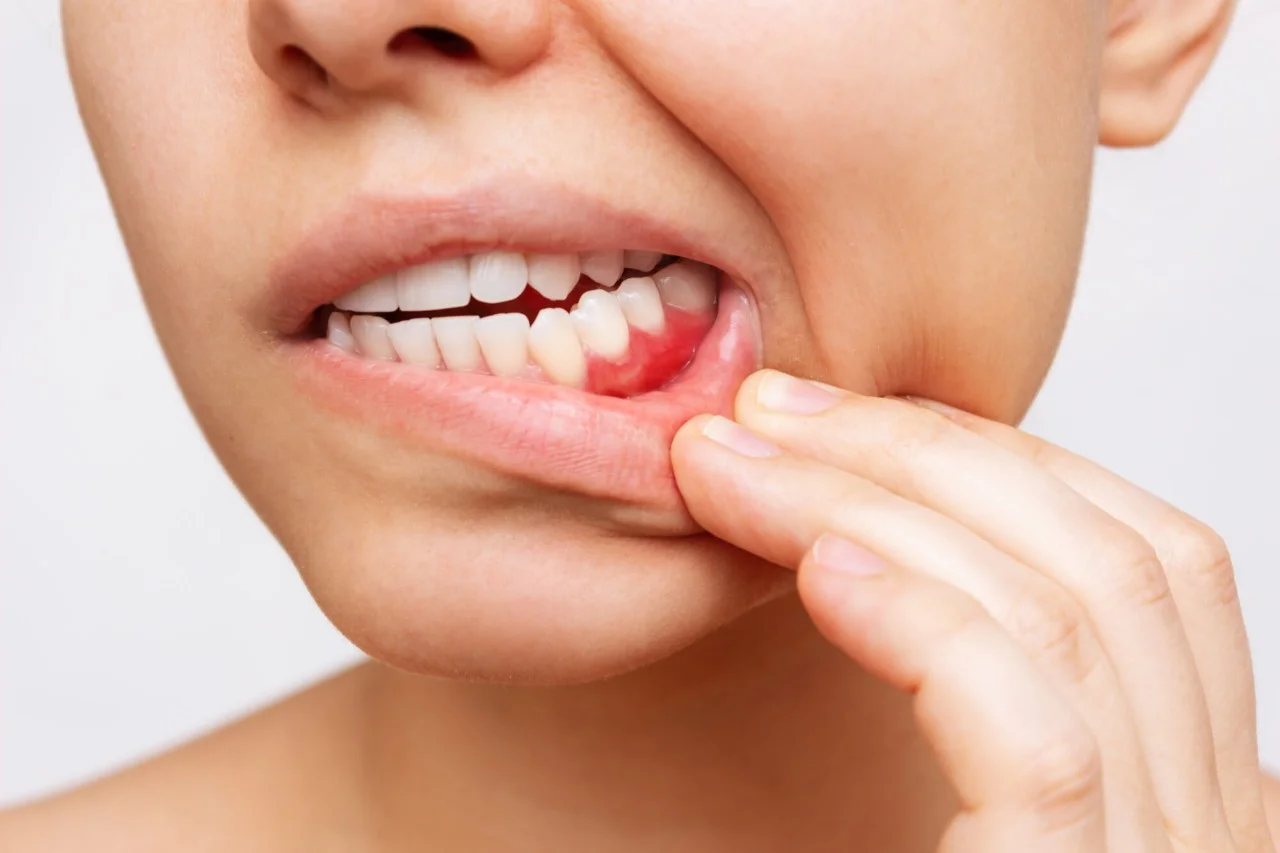 gum disease treatment