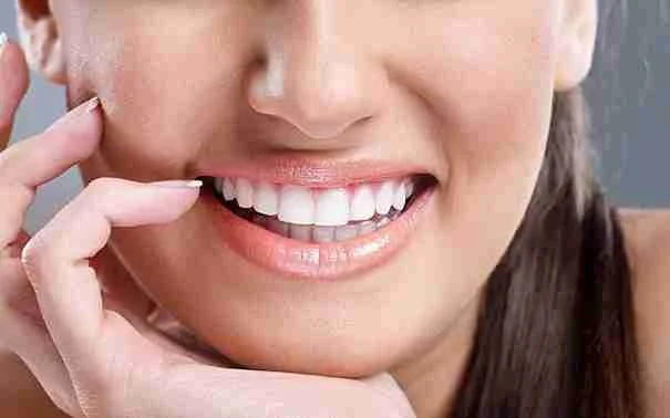 Veneers Pakistan