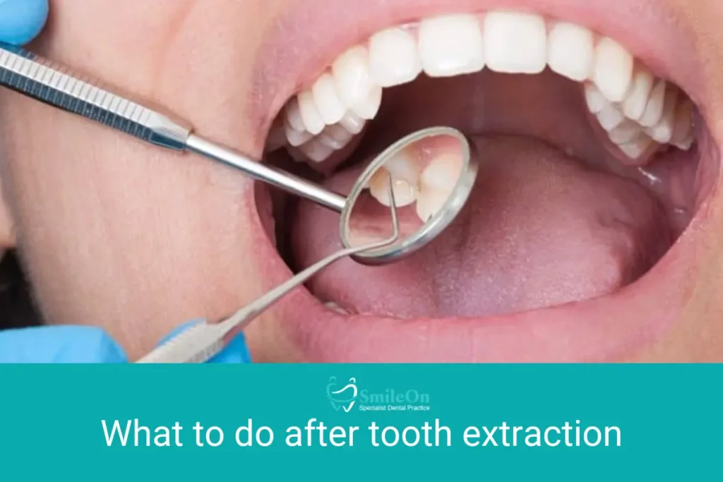 What to do after tooth extraction