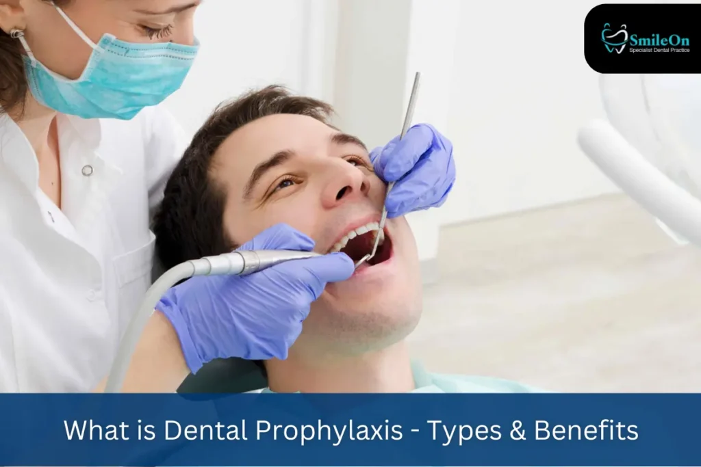 what is dental prophylaxis
