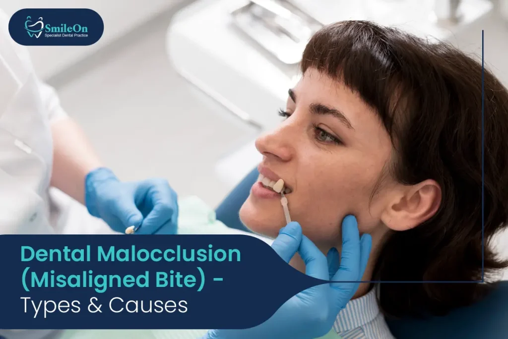 Dental Malocclusion