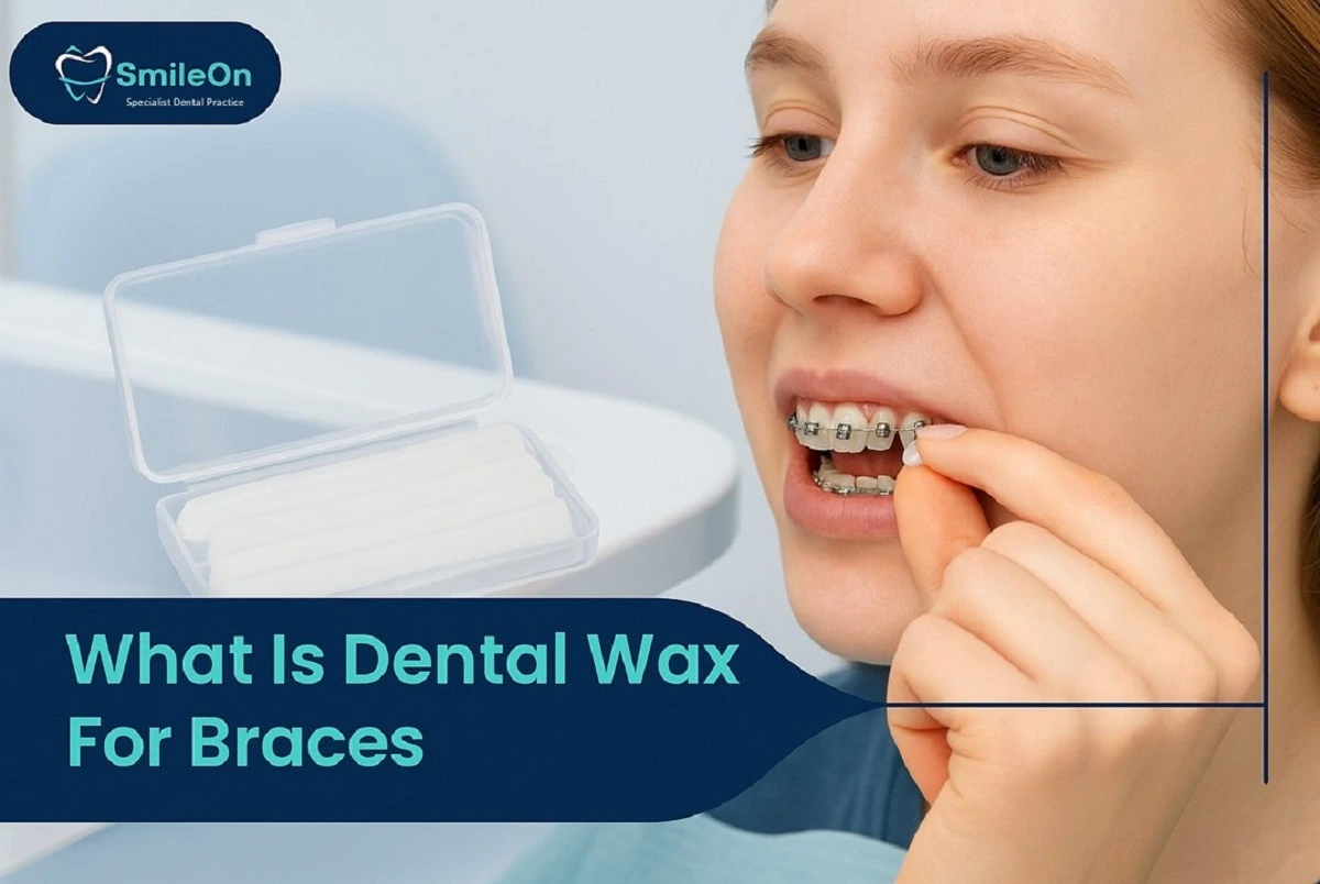 Dental Wax