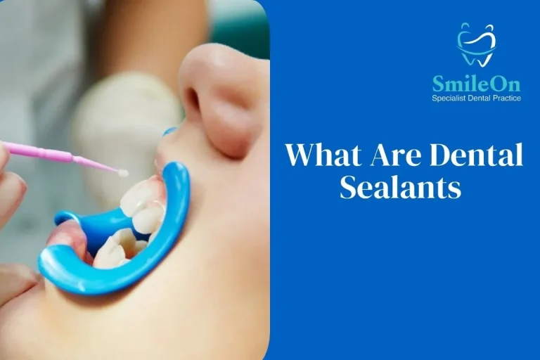 Dental Sealants