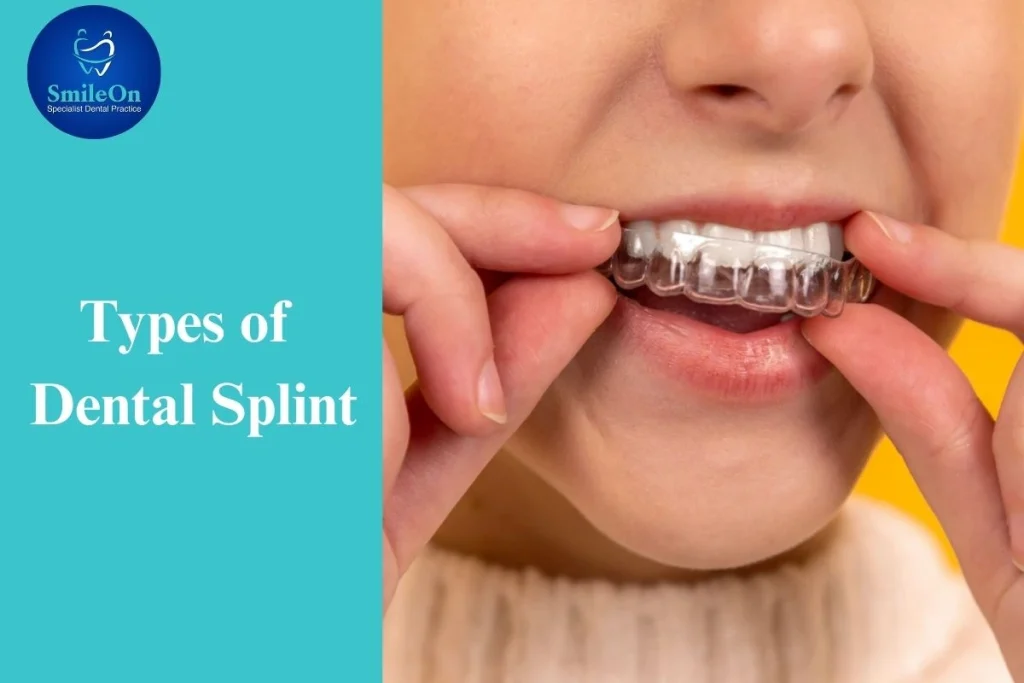 Dental Splint