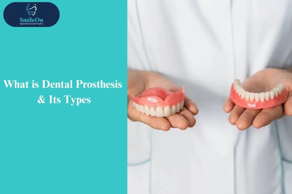 Dental Prosthesis