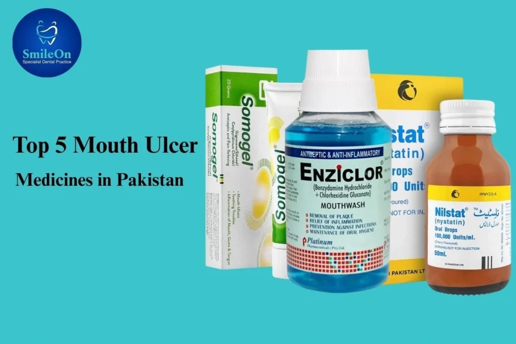 Top Mouth Ulcer Medicines in Pakistan