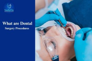 Dental Surgery Procedures