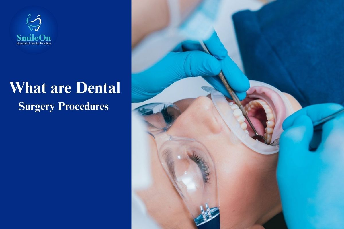 Dental Surgery Procedures