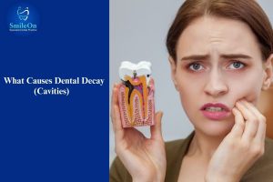 Dental Decay Causes