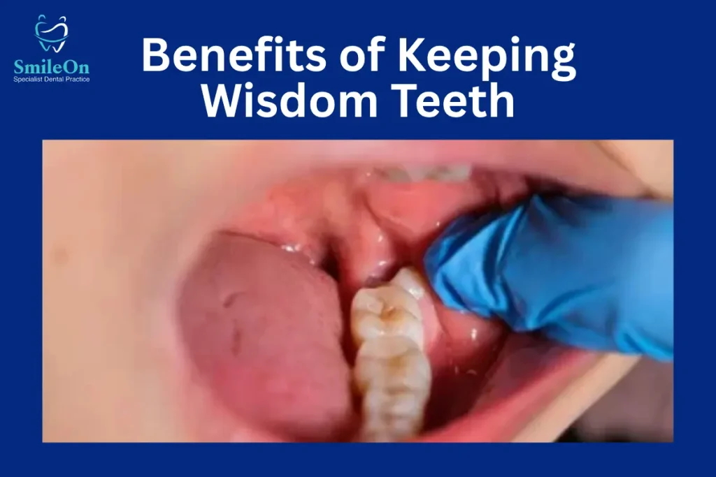 Benefits of Keeping Wisdom Teeth
