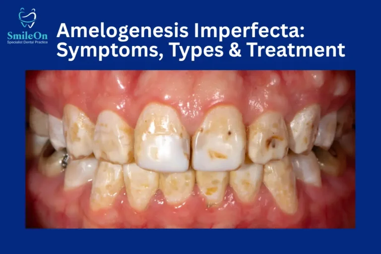 Amelogenesis Imperfecta