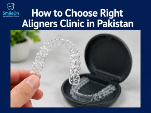 Aligners Clinic in Pakistan