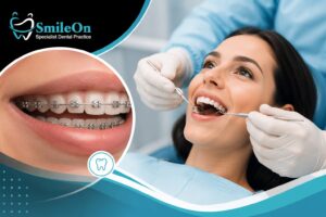 Braces Treatment in Lahore