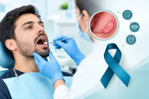 Oral Cancer Treatment